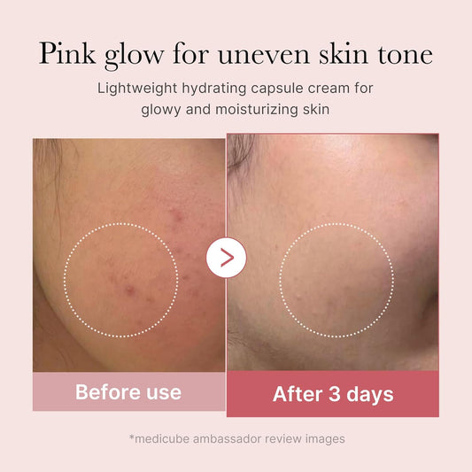 MEDICUBE PDRN Pink Collagen Capsule Cream – Crema viso effetto glow e compattezza
