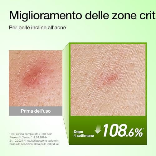 ANUA – Acido Azelaico 10 e Acido Hyaluronico - Siero riequilibrante