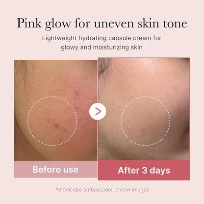MEDICUBE PDRN Pink Collagen Capsule Cream – Crema viso effetto glow e compattezza