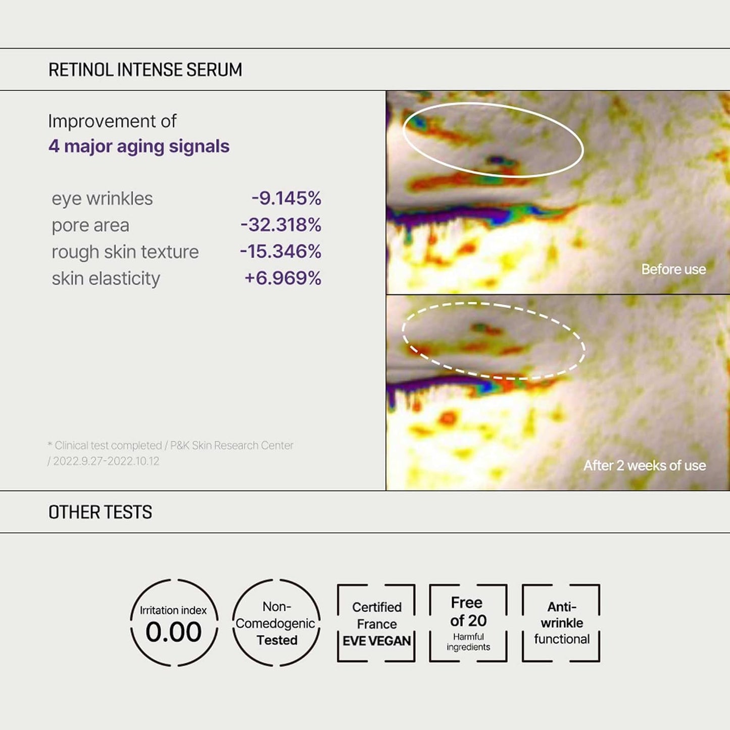 SOMEBYMI Retinol Intense Trial Kit – Kit viso e contorno occhi al retinolo