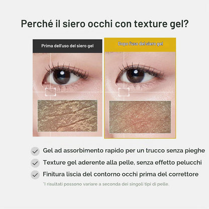 MEDICUBE – Kojic Acid Turmeric Vita Eye Gel Serum - Contorno occhi illuminante con Acido Kojico, Curcuma e Retinolo