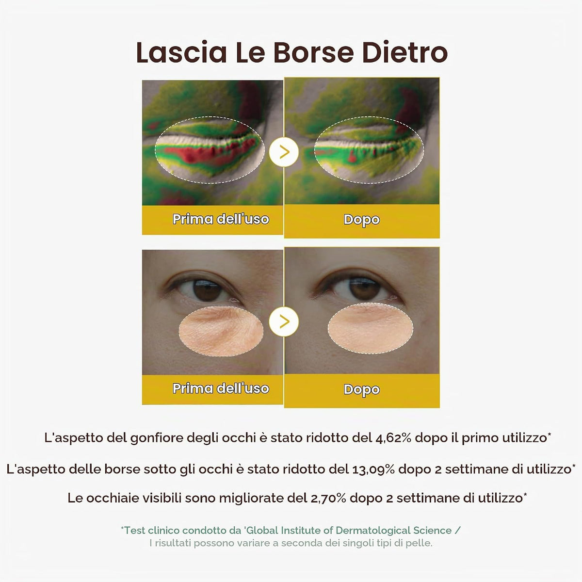 MEDICUBE – Kojic Acid Turmeric Vita Eye Gel Serum - Contorno occhi illuminante con Acido Kojico, Curcuma e Retinolo