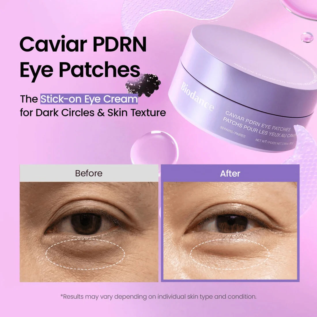 BIODANCE Caviar PDRN Eye Patches – Patch Occhi Hydrogel con Caviale e PDRN 60 pz